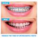 Annhua Orthodontics Plastic Power Chain - Long Light Blue - Size 2# - 15ft Roll - Buy Online on GoSupps.com