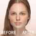 2024 Niacinamide 10% + Zinc 1% Serum for Acne & Oil Control | Refreshing Facial Serum with Roller - Buy Online on GoSupps.com