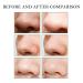 Effective Blackhead Remover Mask & Nose Strips for Clear Skin | International Shipping - Buy Online on GoSupps.com