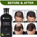 Hair Growth Shampoo Anti-Hair Loss Shampoo Shampoo for Thinning Hair and Hair Loss Strong Natural Organic Ingredients Repairs Damaged Scalp - Buy Online on GoSupps.com