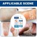 Heel Remover Moisturizing Solution for Dry Feet | 100ml Moisturizer Non Sticky Treatment for Cracked Heels Unisex Men and Women - Buy Online on GoSupps.com