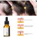 Hair Growth Serum 20ML Anti Hair Loss Hair Growth Essential Oil Fast Hair Growth Serum Hair Loss Treatment (3 pieces) - Buy Online on GoSupps.com