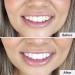 Smirk Teeth Brightening Powder 40g - Natural Whitening Formula | Shop Now - Buy Online on GoSupps.com