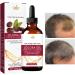 Huile de croissance cheveux - Amplaceur de brillance hydratante formule de r paration de lissage | M lange de stimulation follicules intensifs revitalisant cheveux en profondeur rajeuni - Buy Online on GoSupps.com