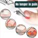 Toenail Clippers Nail Clippers for Thick Nails Heavy Duty Ingrown Thick Toenails Scissors - Buy Online on GoSupps.com