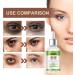 Eye Serum For Firm Skin & Tight Around Eye Eye Serum For Dark Circles & Puffy Eyes Bags Under Eyes Treatment For Women & Men Anti Wrinkle & Anti Aging Eye Serum Reduce Fine Lines - Buy Online on GoSupps.com