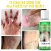 Extra Strength Peeling Oil for Dark Skin - 110ML | Chemical Peel for Face Hands & Feet - At Home Treatment - Buy Online on GoSupps.com