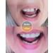airmor Do It Yourself Denture Fake Teeth Top and Bottom Temporary Teeth Easy and Convenient Common to All situations-2 - Buy Online on GoSupps.com