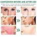 Buy Gaukomzs Green Color Correcting Cream | Hydrating Anti-Redness Pigment Concealer & Sunscreen - International Shipping Available - Buy Online on GoSupps.com