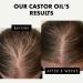 Organic Castor Oil for Hair Growth, Thickness, and Eyelashes - 1oz + Applicator | Eclat Skin Care - Buy Online on GoSupps.com