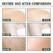 Aloe Vera Body Scrub Aloe Vera Exfoliating Body Scrub Black Underarm Scrub Remove Dead Skin Dust For All Skin Types - Buy Online on GoSupps.com