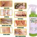 Foot Peeling Spray Orange Oil Foot Peeling Spray That Remove Dead Skin Tea Tree Foot Peeling Spray Remove Dead Skin within Seconds Exfoliator For Cracked Rough Heels Dry Toe Skin&Calluses (Green) - Buy Online on GoSupps.com