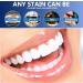 Ninnyi 2PCS Tooth Paint Enamel Instant Teeth Whitening Essence Gel for Stain Removal - Buy Online on GoSupps.com