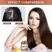 Batana Oil for Hair Growth 120ml Organic Batana Oil Repairs Damaged Hair Eliminates Split Ends and Enhances Hair Thickness for Healthier Thicker Brown - Buy Online on GoSupps.com