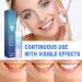 Lovilds Gum Therapy Gel - Complete Reviews Whitening Gel & Essence for Healthier Teeth - Buy Online on GoSupps.com