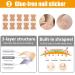Ingrown Toenails Treatment Set | Toenail Correction Patch & Stainless Steel Foot Care Tools - Buy Online on GoSupps.com