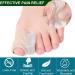 1Pcs Gel Toe Separator Spacer - Bunion Corrector for Hallux Valgus Overlapping Toes Blisters & Corns - Comfort & Relief - Buy Online on GoSupps.com
