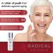 Radical Skincare Youth Infusion Serum - Even Skin Tone Reduce Fine Lines & Wrinkles Hydrates for All Skin Types - Paraben & Cruelty Free (1 oz - Buy Online on GoSupps.com