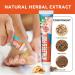 Foot Fungus Ointment Antipruritic Fungal Ointment Beriberi Treatment Cream 20 Grams Of foot Odor Beriberi Antipruritic and fungal Beriberi Care Ointment - Buy Online on GoSupps.com