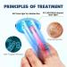 Blue Nail Fungus Laser Treatment Device- Clip-on Design, Targets Damaged Toenails - Buy Online on GoSupps.com