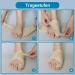 Hallux Valgus Correction Rail - Big Toe Pain Relief & Toe Alignment Bandage for Men & Women (Beige Right) - Buy Online on GoSupps.com