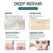 Silicone Scar Sheets 1.6 x 120 Large Roll - Waterproof Soft Strips for Acne, C-Section, Keloid, and Burn Scars - Skin Care - 10-12 Month Supply - Buy Online on GoSupps.com