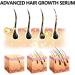 Hair Growth Serum Organic Castor Oil Anti Hair Loss Hair Serum for Thinning Balding Thin Hair Fast Growth Strengthen Hair Roots for Men & Women Damaged Hair Repair - Buy Online on GoSupps.com