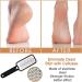 Best Fro e Files: Corneal Remover Pedicure Tool for Wet & Dry Feet - Ultimate Foot Care Solution - Buy Online on GoSupps.com