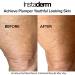 Instaderm Crepe Fix Body Restorative Cream Anti-Aging Wrinkle Cream Support Skins Natural Elastin & Collagen Production to Restore Lift Tighten Hydrate & Smooth Thinning Aged Crepey Skin. 4OZ - Buy Online on GoSupps.com