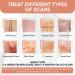 Extra Long Silicone Scar Sheets with Allantoin & Onion Extract - 150 x 1.6 inches for Keloid Removal & Post-Surgery Care - Reusable Scar Patches - Buy Online on GoSupps.com