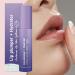 Lip Moisturizer Lip Plumper | 4ml Lip Filler for Dry Lips Body Skin Care and Makeup Supplies Beauty Accessories for a Healthy Look - Buy Online on GoSupps.com