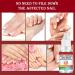 Fungal Nail Treatment Solution - Extra Strong Repair for Toenails & Fingernails - Safe & Effective - 2pcs x 1.00 ml - Buy Online on GoSupps.com