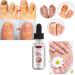 Kerassentials Anti-Fungus Relief Oil for Toenail Fungus - Strong Nails Solution (3pcs) - Buy Online on GoSupps.com