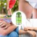 Anti Irritation Cream Extra Strength Anti Itch Lotion | 35g Natural Moisturizing Ointment for Hand Feet Body & Face - Buy Online on GoSupps.com