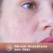 AUSLKA Blemish Patches - 4 Size (174 Patches) - Hydrocolloid Blemish Patch - Invisible Spot Cove - Spot Dots - for Face Zit Patches 175 Count (Pack of 1) - Buy Online on GoSupps.com