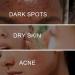 Dark Spot Remover for Face and Body Freckle Removel Cream Pigmentation Removal Melasma Cream Dark Spot Corrector Dark Spot Remover for Face Age Spot Remover for Face Dark Age Spot Remover - Buy Online on GoSupps.com