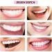 Pulunto DIY Dental Calculus Kit | Tooth Crystals with UV Light & Glue | Tooth Jewelry & Reflective Diamond Kit for Unique Tooth Decoration - Buy Online on GoSupps.com