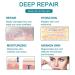 Silicone Scar Sheets 1.6x60 inches - Professional Scar Removal for C-Section, Surgery, Burn, Keloid & Acne - Buy Online on GoSupps.com