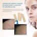 Aroamas Silicone Scar Removal Sheets 4-Pack - Effective for C-Section, Surgery, Burn, Keloid Scars - Soft Adhesive Fabric Strips - 2 Month Supply - Buy Online on GoSupps.com