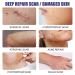Invisible Silicone Scar Sheets | Promotes Circulation | Surgical & Caesarean Scar Removal Strips - Buy Online on GoSupps.com