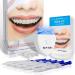 Teeth Whitening light Products 5X Teeth Whitening Gel 2X Teeth Whitening Trays for Rapid Tooth Whitening