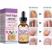Fungal Nail Treatment - Toe Nail Fungal Treatment - Nail Fungus Treatment for Toenail and Fingernails - Anti fungus Nail Repair and Strengthen Fix & Renew Damaged Broken Nails - Buy Online on GoSupps.com