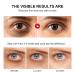 Retinol Eye Stick - Anti-Aging Under Eye Cream with Collagen & Hyaluronic Acid | Reduce Fine Lines & Dark Circles - Buy Online on GoSupps.com