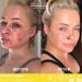 facetheory Retin-C Vitamin Oil O9 - Acne Scar Face Oil Loaded With Vitamin C and Vitamin E Gentle On Skin Non-comedogenic Base Vegan and Cruelty-Free Made in the UK | 100 ml - Buy Online on GoSupps.com