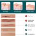 Silicone Scar Sheets Reusable Medical Grade Thinken Scar Sheet for C-Section Tummy Tuck Keloid Surgical Scars Post Surgery Supplies (16pcs-5.9"x1.6"Each Silicone Scar Sheet) - Buy Online on GoSupps.com