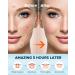 LitBear Acne Pimple Spot Patches - 80 Count Hydrocolloid Treatment for Face, Chin, Body with Tea Tree & Calendula Oil - Large Zit Breakouts Relief - Buy Online on GoSupps.com