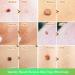 Micro Skin Tag Remover Kit with 24 Bands for Face, Neck, and Body - Mole and Skin Tag Removal Tool for 2-4mm Micro Skin Tags - Buy Online on GoSupps.com