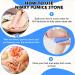2 Pcs Glass Pumice Stone Set - Foot and Hand Callus Remover & Scrubber for Skin Exfoliation | Pedicure Exfoliator Tool for Home Pedicure - Buy Online on GoSupps.com
