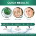 VANELC Eye Mask - Collagen Seaweed Under Eye Patches for Dark Circles Puffiness & Wrinkles | Natural Eye Treatment Gel - Buy Online on GoSupps.com