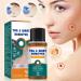 Beauty Grain Corrector | Quick Wart Removal 20ml Blemish Corrector Solution Beauty Home Travel Pre-Event Personal Toiletry Women Men - Buy Online on GoSupps.com